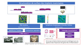 Les instituts Carnot ARTS et MICA permettent au Groupe Sebbin de se situer à l’avant-garde des recherches sur la structuration de surface de ses implants mammaires